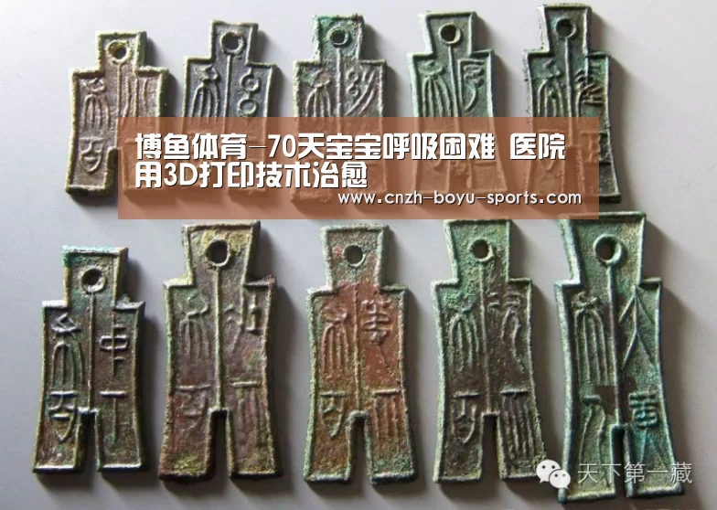 博鱼体育-70天宝宝呼吸困难 医院用3D打印技术治愈(图1) 博鱼体育